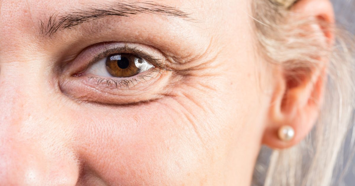 Riduri, povești pe chip: Îmbătrânire sau viață trăită din plin?