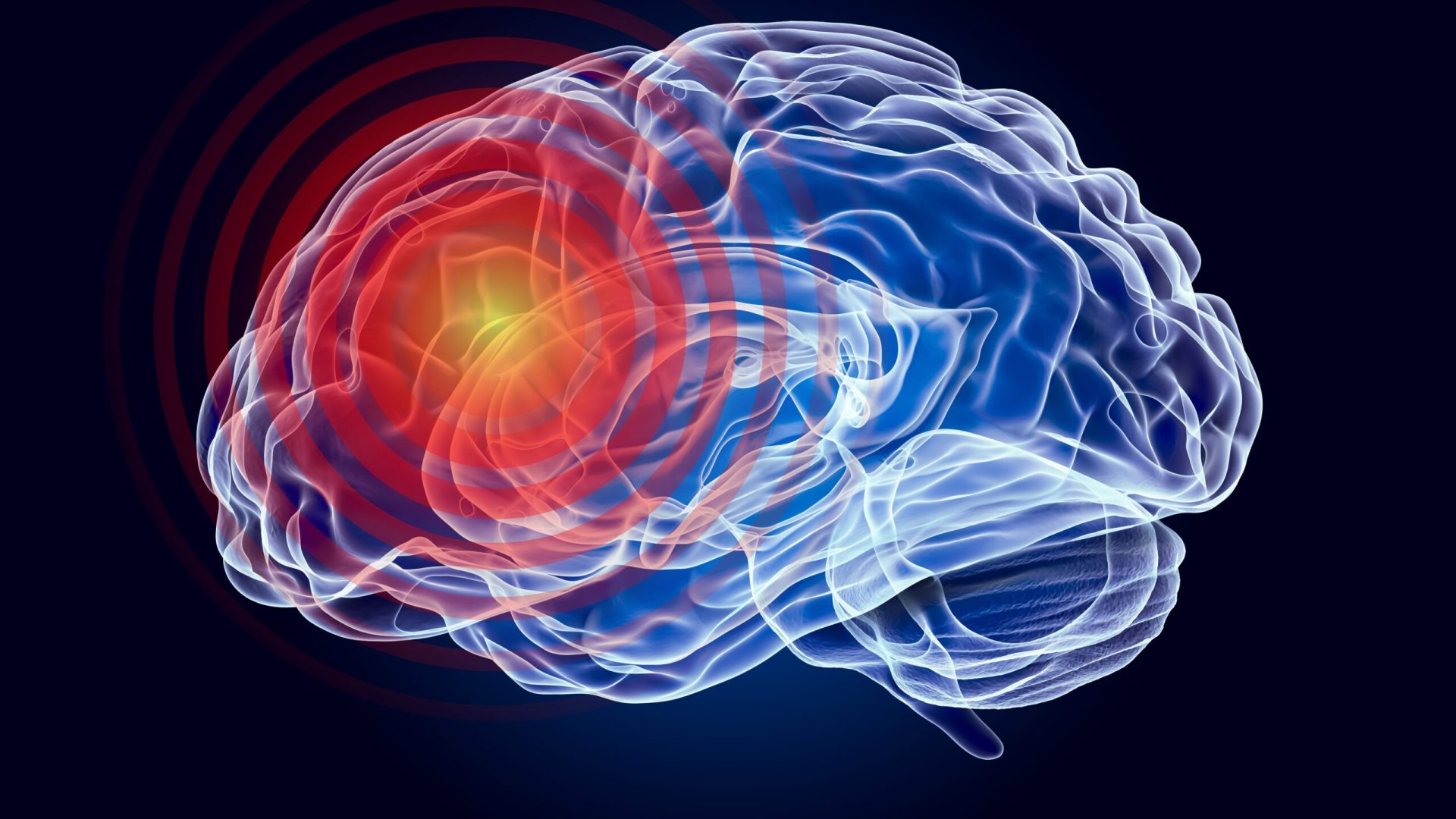 O nouă tulburare neurologică, descoperită de oamenii de știință Oamenii de știință au identificat o tulburare de dezvoltare neurologică necunoscută până acum, cu o bază genetică
