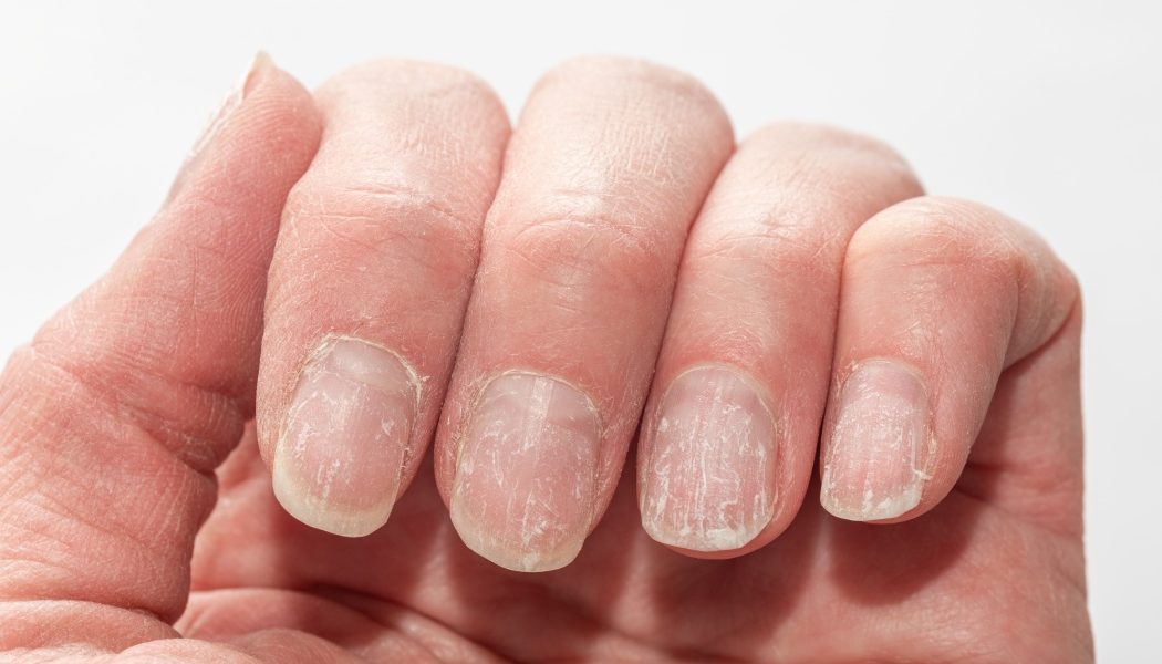 unghii.jpg - NewsFactor