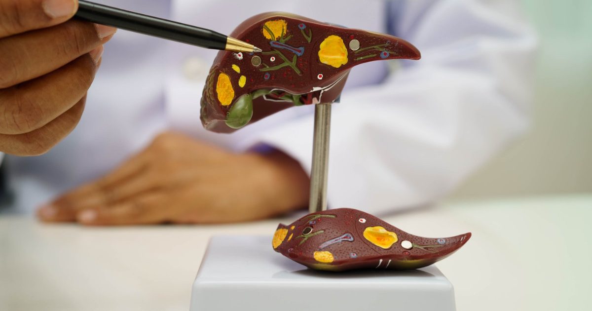 Boala ficatului gras: Atentie la acest „simptom” ascuns