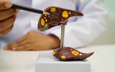 Boala ficatului gras: Atentie la acest „simptom” ascuns