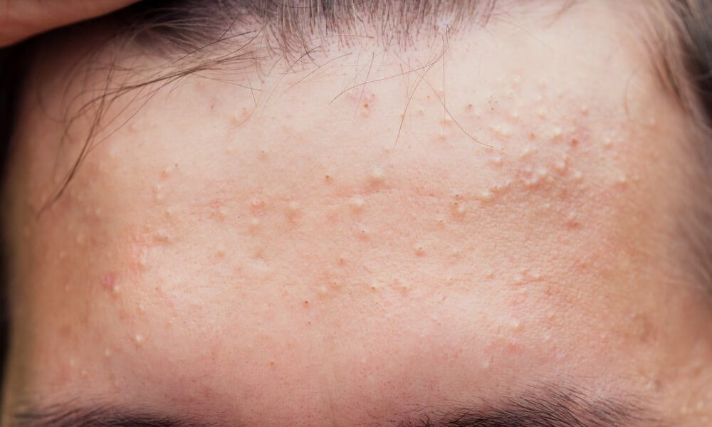 Protocol P: Trei pași simpli pentru oricine, chiar și Donald Trump