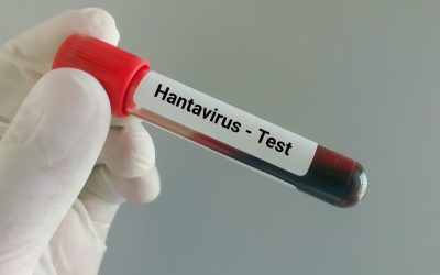 Hantavirus la Arad: Ancheta epidemiologică, ce spun medicii despre virus