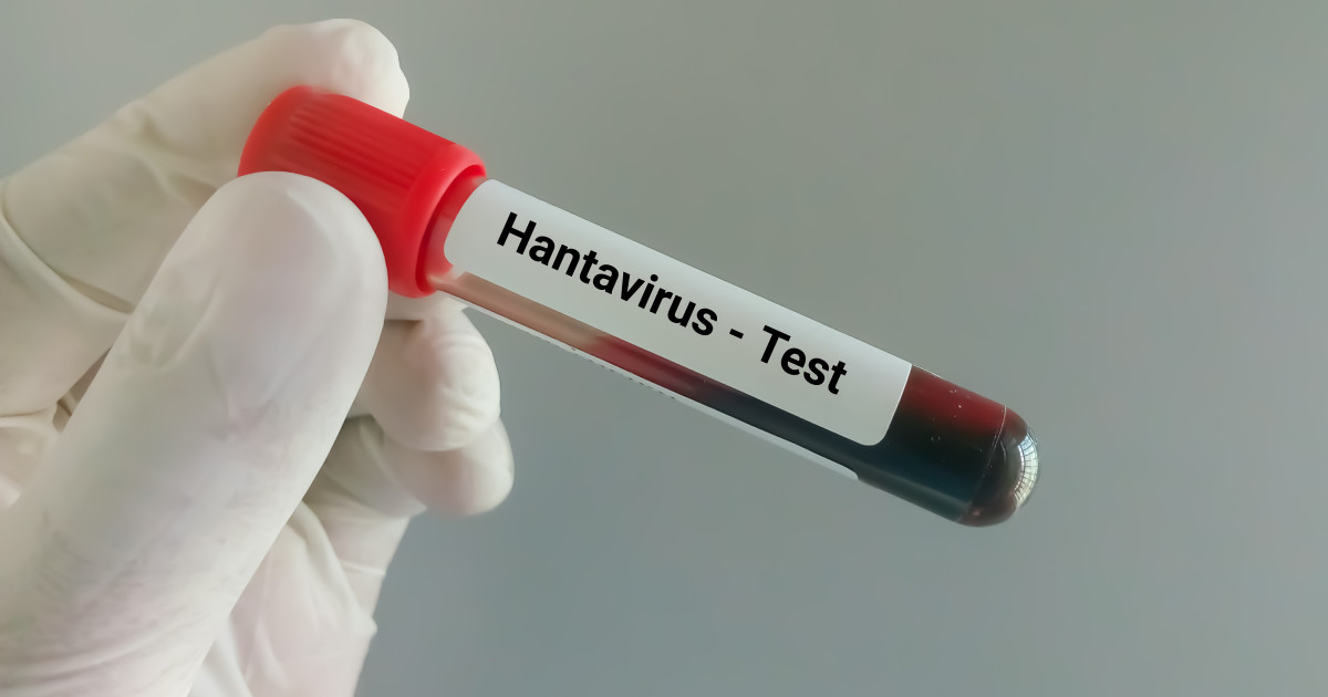 Hantavirus la Arad: Ancheta epidemiologică, ce spun medicii despre virus