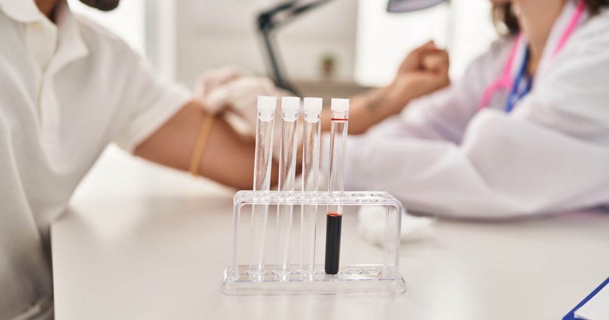 Analize Sânge: 5 Teste Cruciale Înainte de Sală