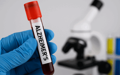Alzheimer, transmisibil prin sânge? Șocul unui studiu românesc