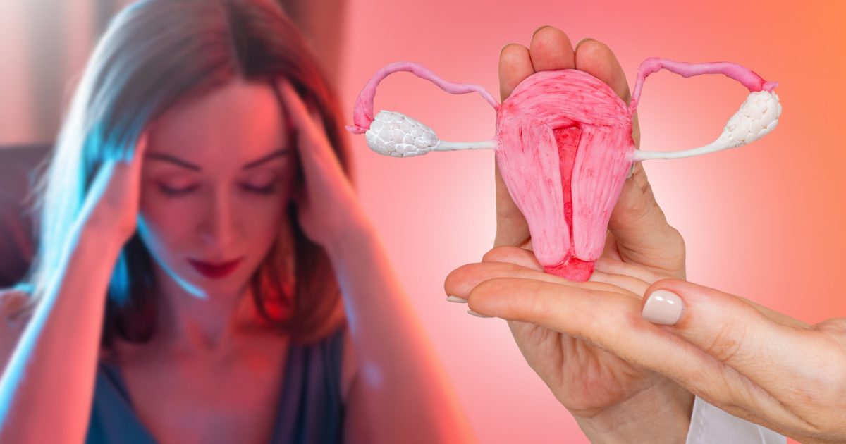 Endometrioza și cancerul ovarian: Simptomele cheie de urmărit