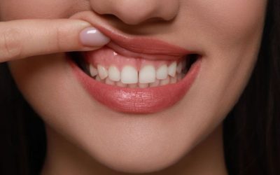 Semnul din gură: Pericol ascuns pentru sănătate