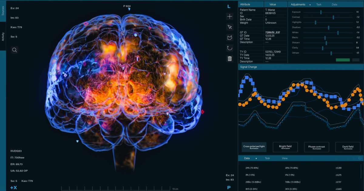 Gândirea liberă, mai puțin control cerebral