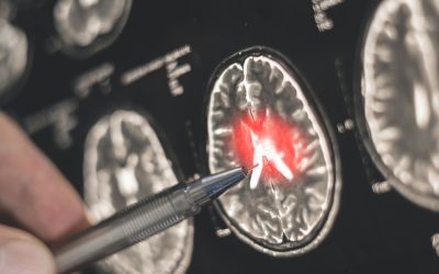 Creierul: Iubirea și frica se suprapun. Ce au aflat oamenii de știință