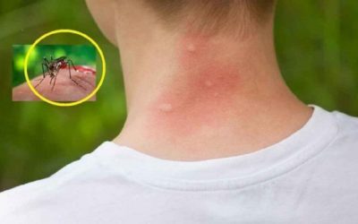 Țânțarii te preferă: 3 bacterii care explică mușcăturile