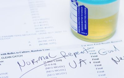 Test urină: Depistează 90% din cancerul de vezică