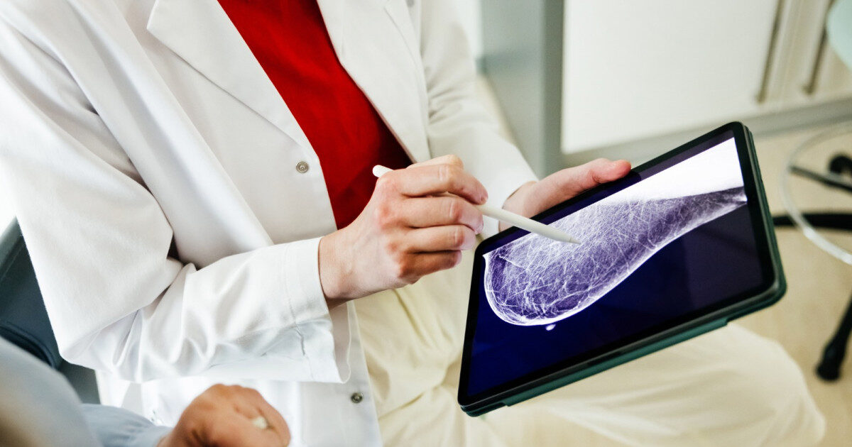Medicament post-naștere reduce riscul de cancer la sân